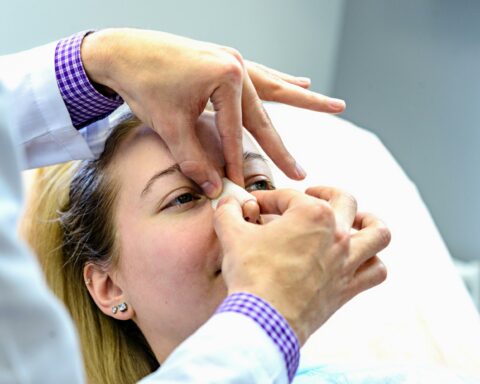 Medical professional inserts nasal gauze into a patient’s nostril during a procedure, patient lying down.