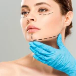 Close-up of a woman's face with black surgical markings along the jawline and cheek, blue-gloved hand supporting her chin.
