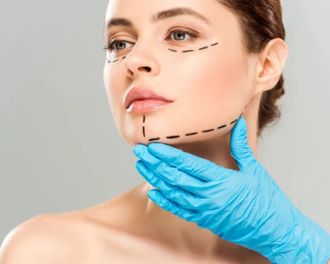 Close-up of a woman's face with black surgical markings along the jawline and cheek, blue-gloved hand supporting her chin.